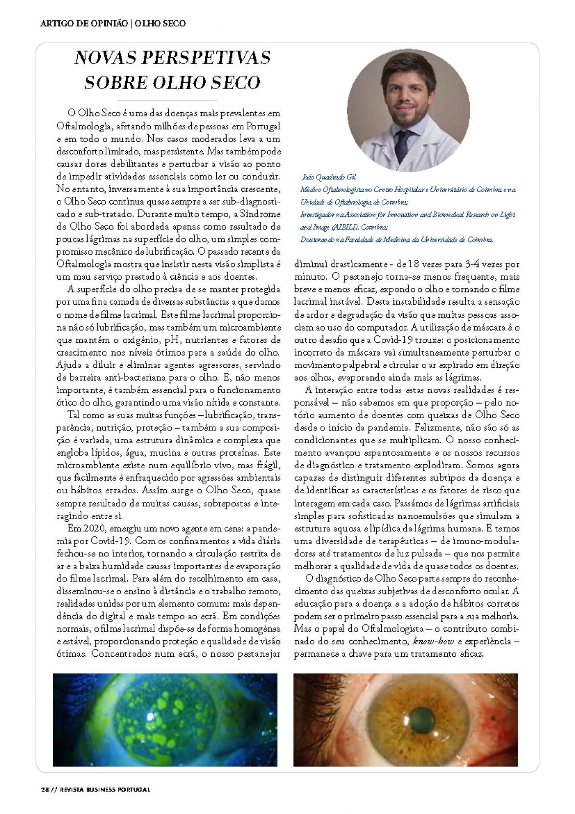 Artigo sobre Olho Seco